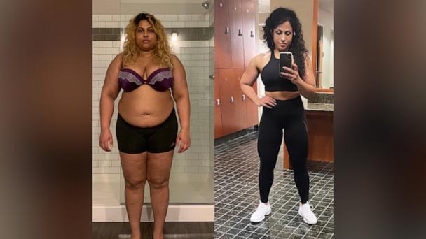 Unbelievable Achievement: Woman Sheds 120 Pounds and Triumphs in Mental and Physical Wellness
 
