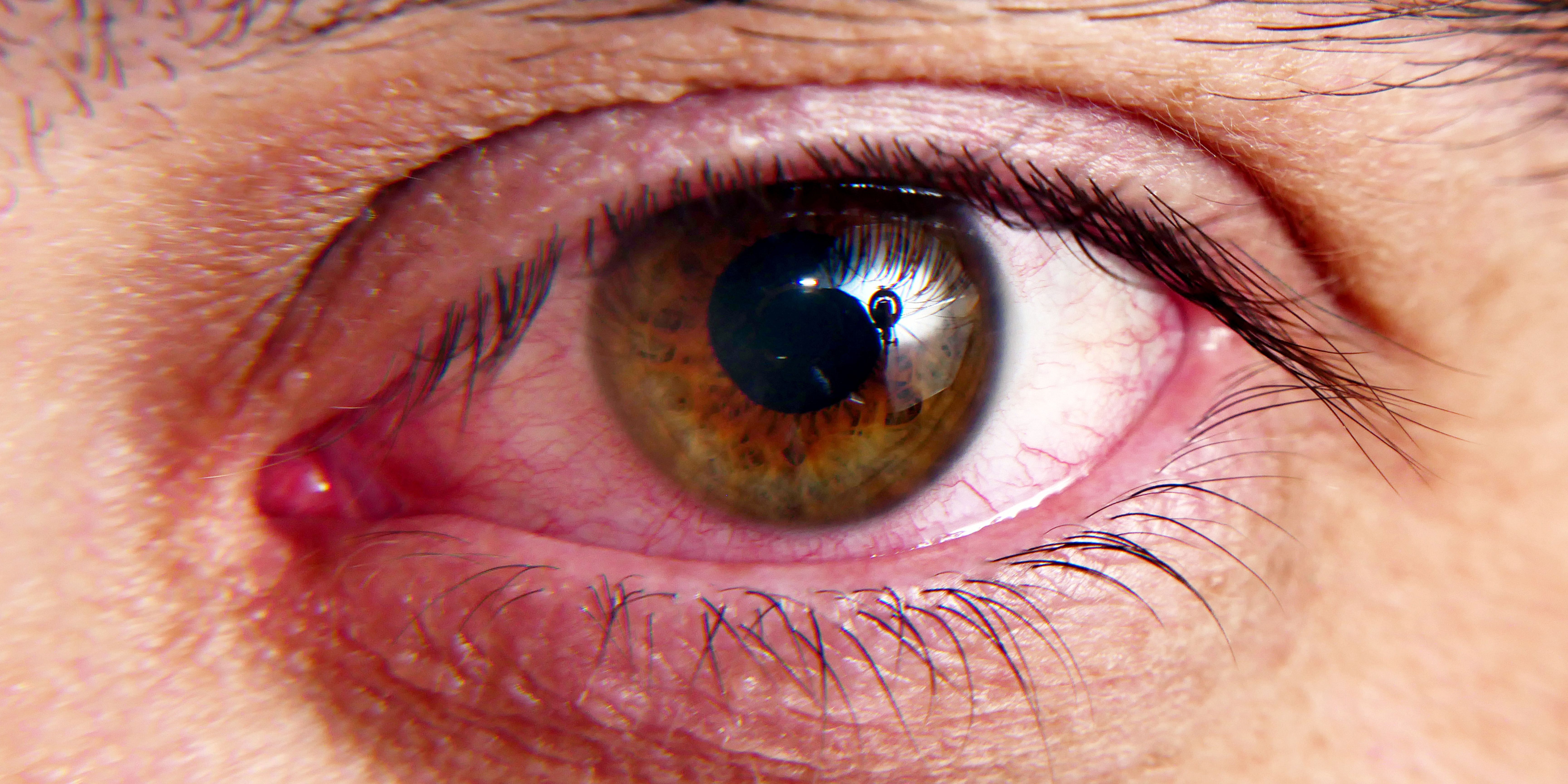 Feel Your Eyes They All Over Metimeline Groups - 2lowajd