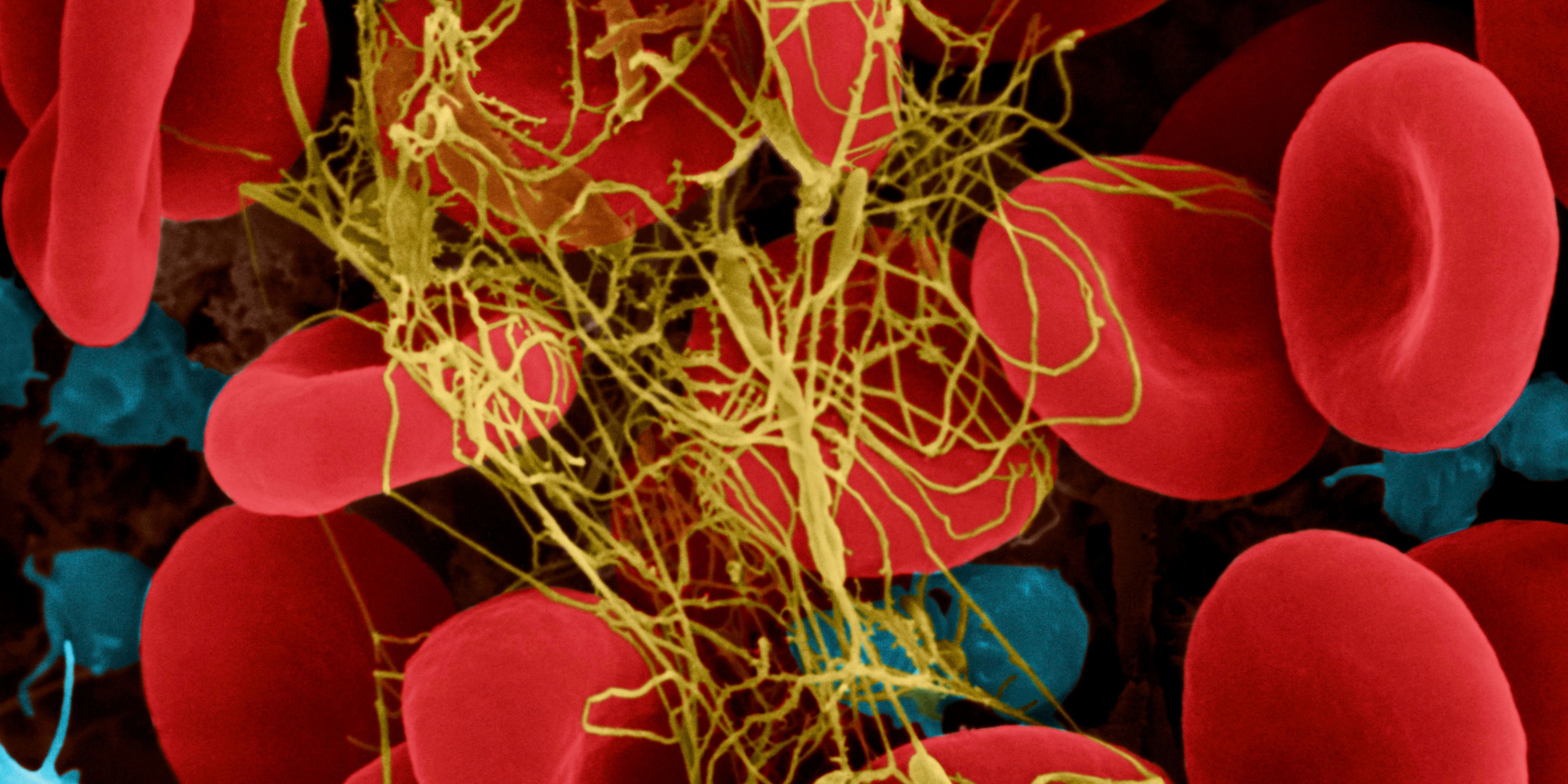 Urgent:  Recognize These Blood Clot Signs After A Hickey - uapoi53
